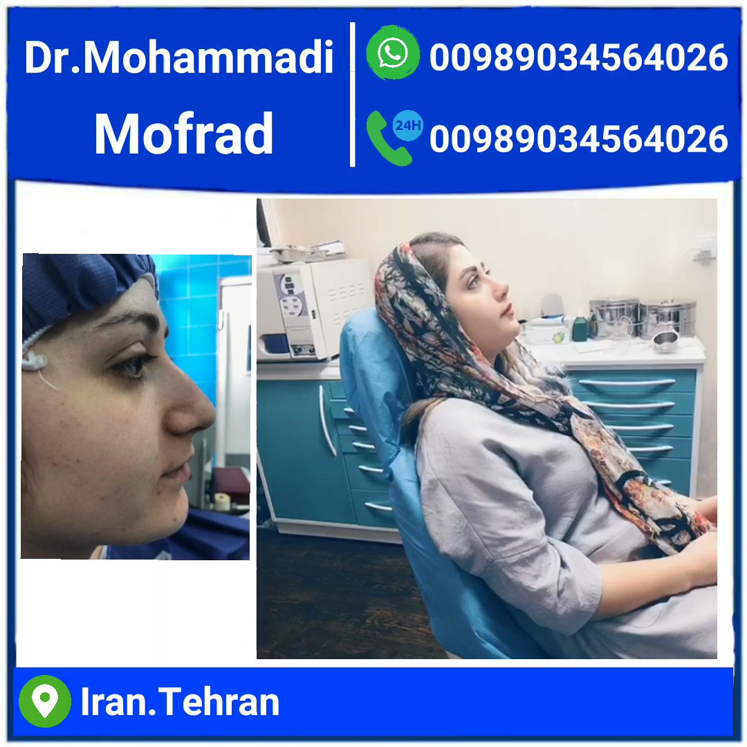 Nasal Cosmetic Surgery Dr. Amir Hossein Mohammadi Mofrad